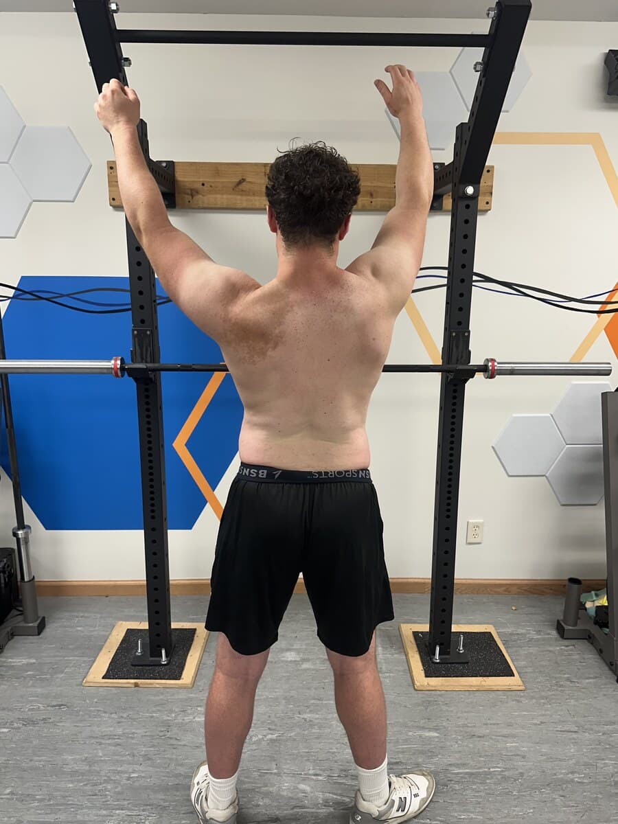Brody Before (Overhead reach)