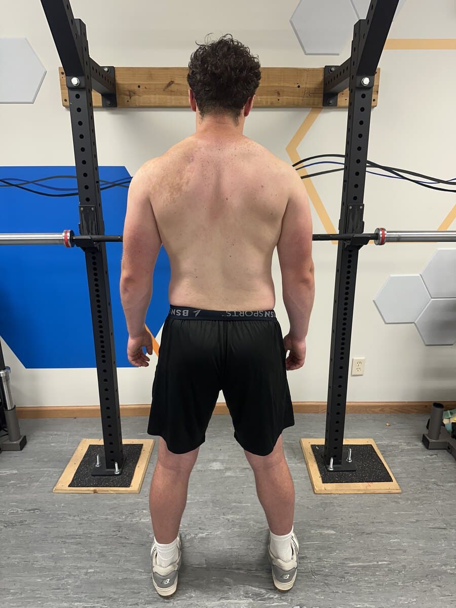 Brody After (Posture)