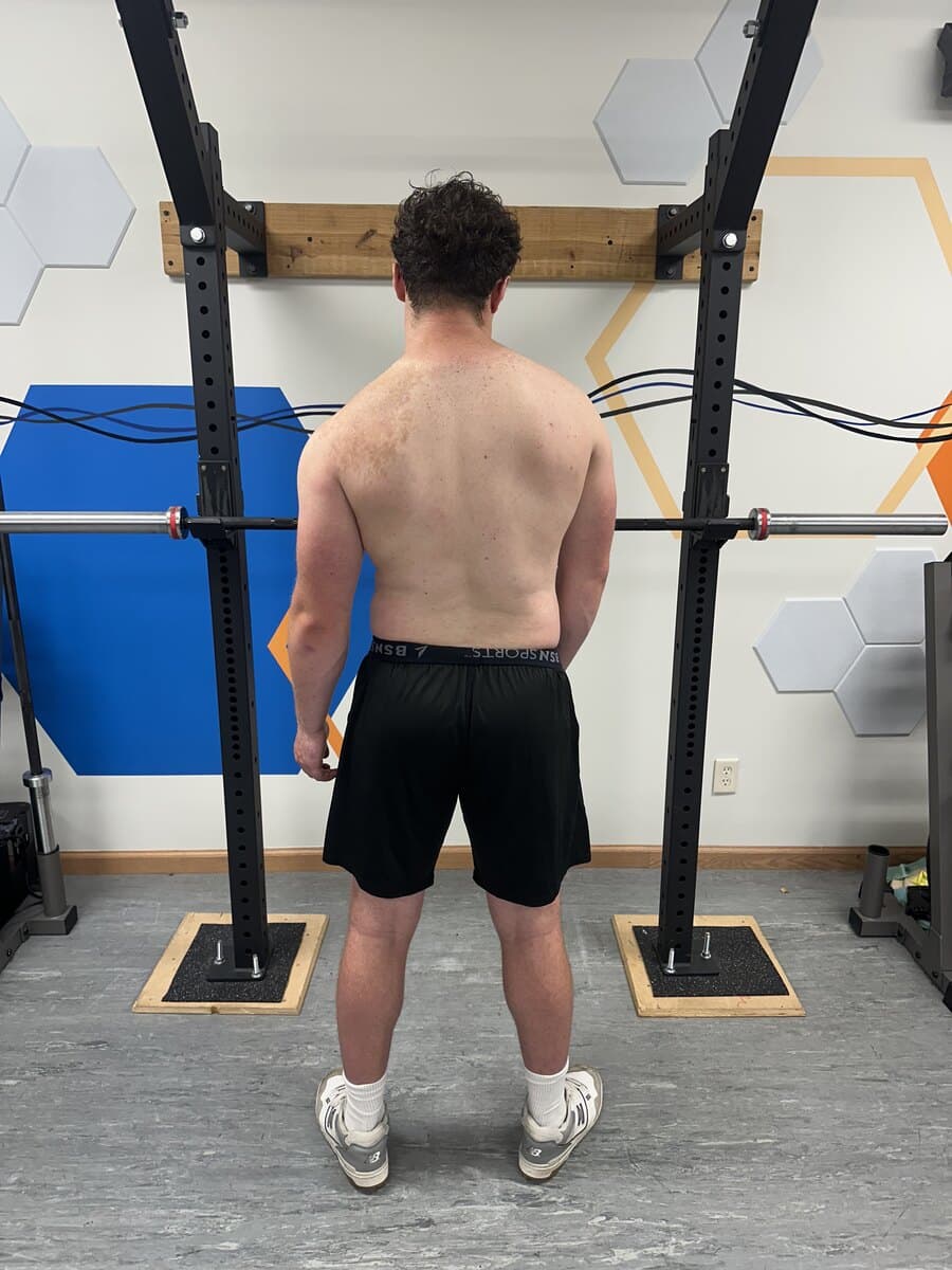 Brody Before (Posture)